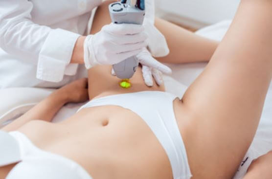 All About Laser Hair Removal for Intimate Areas