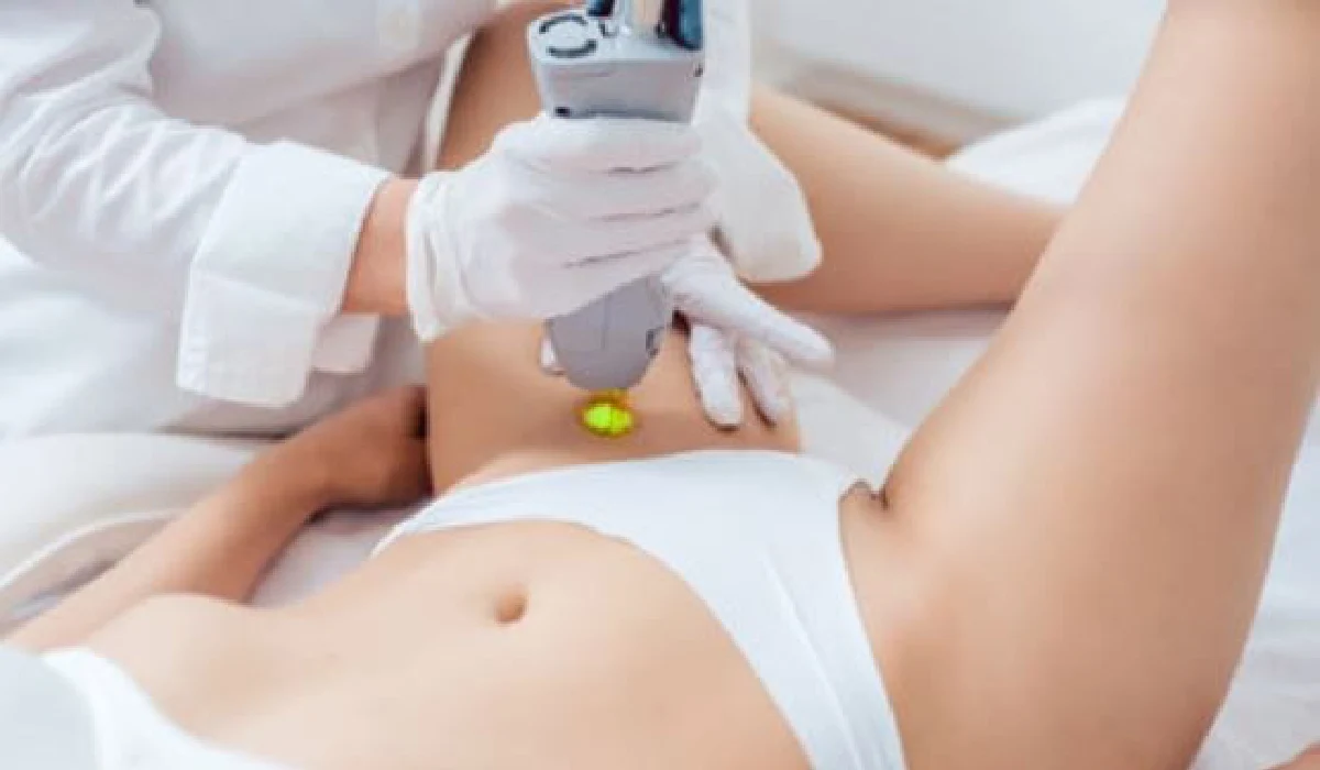 Laser-Hair-Removal-for-Intimate-Areas