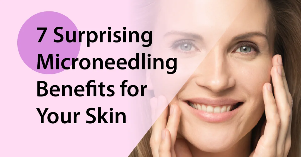 7 Benefits You Can Expect from Microneedling