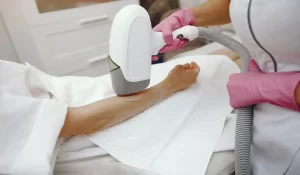 Laser Hair Removal for Ingrown Hair