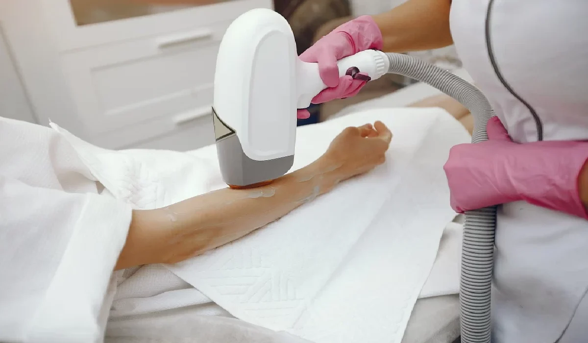 Laser Hair Removal for Ingrown Hair