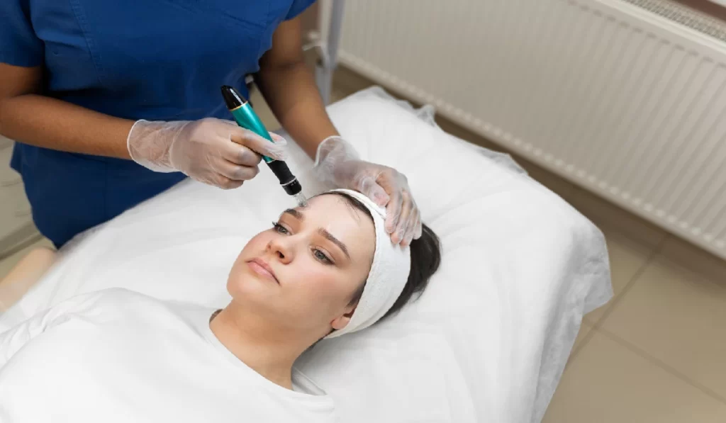 Microneedling and Chemical Peels